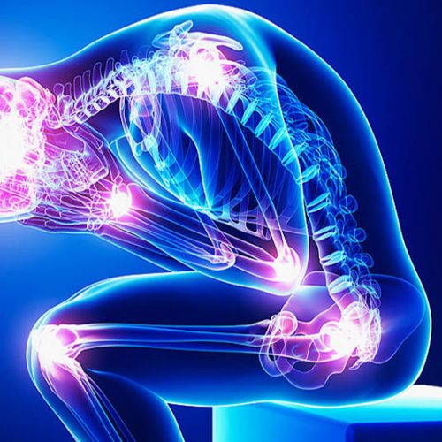 chronicpain-ph